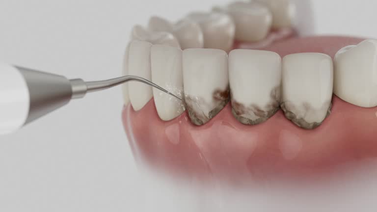 Reliable Wisdom Tooth Removal contractor in Brooks County County, GA by Dentist Open Now